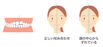 矯正治療で、輝く笑顔を応援いたします。